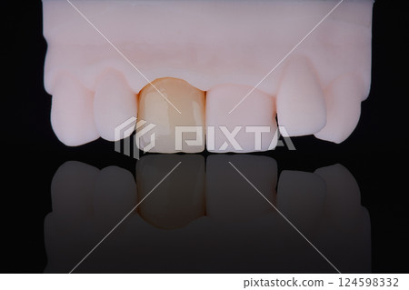 Mirror copy of central maxillary incisor, ultra thin dental ceramic veneer or crown on printed model Mirror copy of central maxillary incisor, ultra thin dental ceramic veneer or crown on printed model 124598332