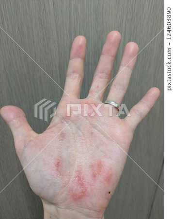 Rough hands④ Rough hands④ 124603890