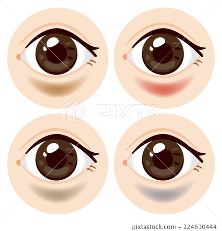一組有黑眼圈的眼睛插圖 124610444