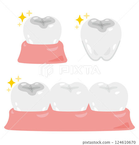 Silver filling illustration set Silver filling illustration set 124610670