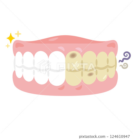 Illustration of clean and dirty dentures: Half & Half 124610947
