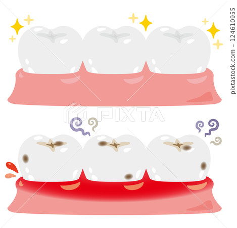 Illustration set of healthy and clean teeth and inflamed unhealthy teeth Illustration set of healthy and clean teeth and inflamed unhealthy teeth 124610955