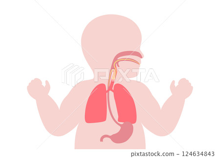 Aspiration pneumonia poster Aspiration pneumonia poster 124634843