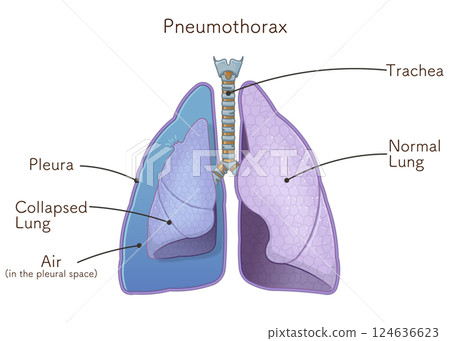 lung, pulmonary, internal organ 124636623