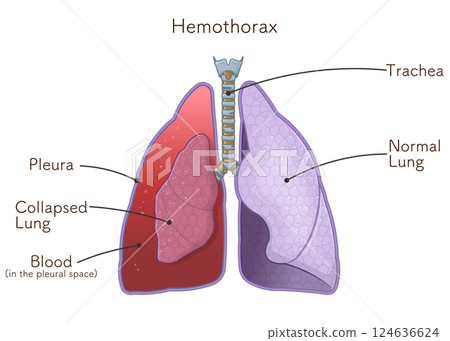 lung, pulmonary, internal organ 124636624