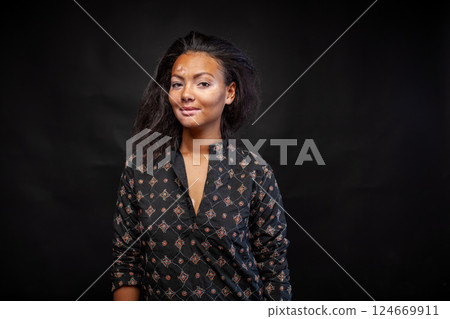 Smiling woman in black kurta with vitiligo 124669911