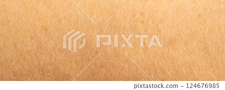 Skin mole spot closeup. Human birthmark, nevus macro texture 124676985