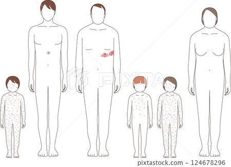帶狀皰疹和水痘。兒童和成人症狀說明 124678296