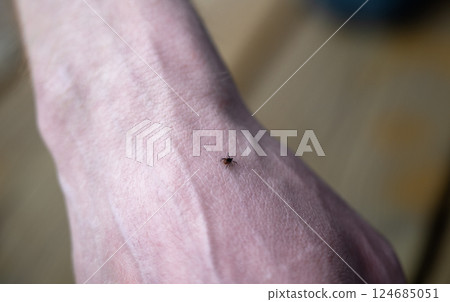 tick walking on the hand. It is a dangerous arachnid that is a carrier of many pathogens tick walking on the hand. It is a dangerous arachnid that is a carrier of many pathogens 124685051