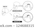 顳顎關節障礙的症狀和解釋的單調插圖 顳顎關節障礙的症狀和解釋的單調插圖 124688315