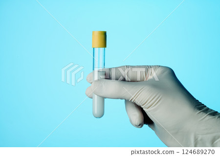 man holds a test tube with some semen man holds a test tube with some semen 124689270