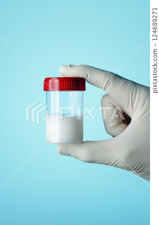 healthcare worker holding a container with semen 124689271
