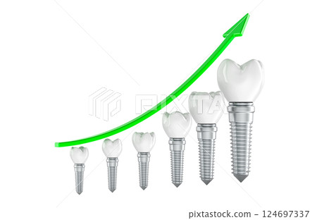Growing chart from Dental Implant. 3D rendering Growing chart from Dental Implant. 3D rendering 124697337