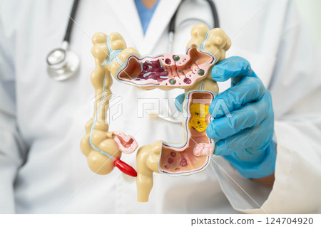 Intestine, doctor holding human anatomy model for study diagnosis and treatment in hospital. 124704920