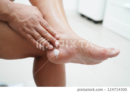 Asian woman check feet with crack and dry heel skin, Diabetic Foot. Asian woman check feet with crack and dry heel skin, Diabetic Foot. 124714300