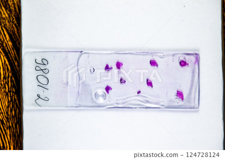 Slices of the tumor under glass. Histological examination of tumor cells for the presence of cancer Slices of the tumor under glass. Histological examination of tumor cells for the presence of cancer 124728124