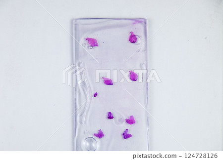 Slices of the tumor under glass. Histological examination of tumor cells for the presence of cancer Slices of the tumor under glass. Histological examination of tumor cells for the presence of cancer 124728126