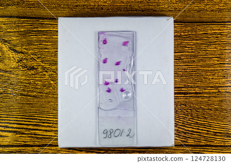 Slices of the tumor under glass. Histological examination of tumor cells for the presence of cancer 124728130