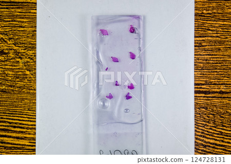 Slices of the tumor under glass. Histological examination of tumor cells for the presence of cancer 124728131