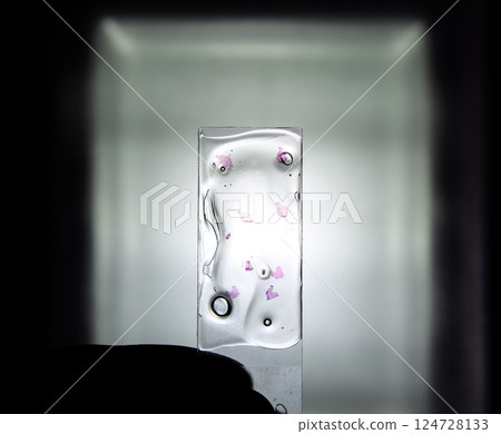 Slices of the tumor under glass. Histological examination of tumor cells for the presence of cancer Slices of the tumor under glass. Histological examination of tumor cells for the presence of cancer 124728133