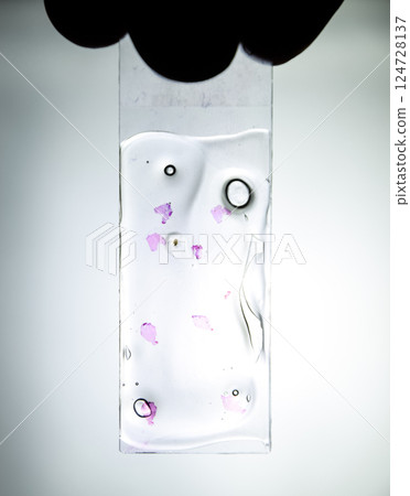 Slices of the tumor under glass. Histological examination of tumor cells for the presence of cancer 124728137