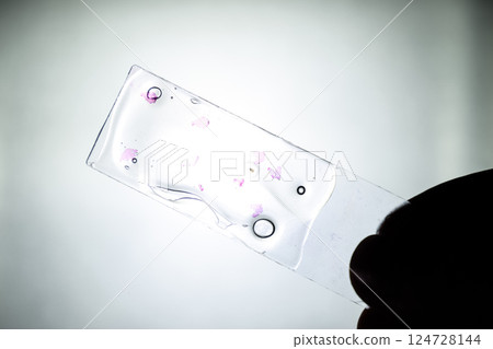 Slices of the tumor under glass. Histological examination of tumor cells for the presence of cancer 124728144