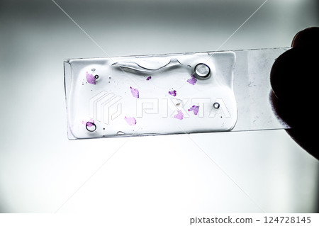 Slices of the tumor under glass. Histological examination of tumor cells for the presence of cancer 124728145