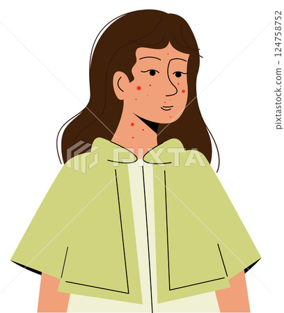 Danger of human viruses illustration. Infected girl flat cartoon concept. Monkeypox on human skin closeup Danger of human viruses illustration. Infected girl flat cartoon concept. Monkeypox on human skin closeup 124758752
