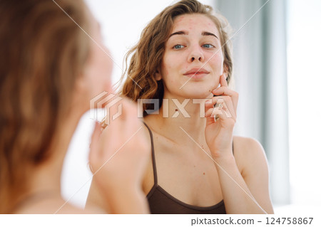 Beautiful woman with acne problem skin checks dry face skin. Red spots, rash, acne. Skin treatment. 124758867