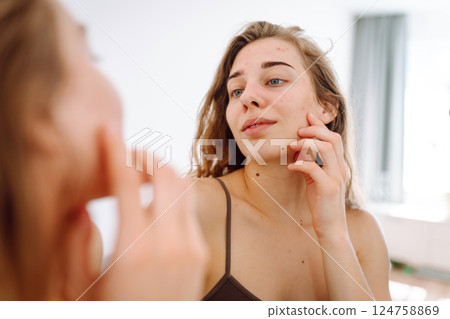 Beautiful woman with acne problem skin checks dry face skin. Red spots, rash, acne. Skin treatment. Beautiful woman with acne problem skin checks dry face skin. Red spots, rash, acne. Skin treatment. 124758869
