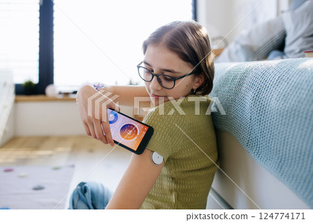 Diabetic girl with CGM sensor checking her blood sugar in app. Diabetic girl with CGM sensor checking her blood sugar in app. 124774171