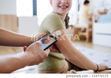 Diabetic girl with a CGM sensor on her arm. 124774175