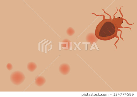 Bed Bug Crawling on Skin Leaving Red Bites Marks 124774599