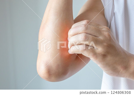 Young asian man itching and scratching on arm from allergic itchy dry skin eczema dermatitis insect bites 124806308