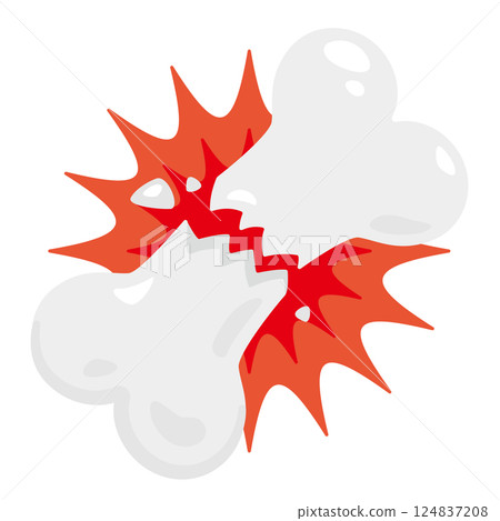 Broken bone illustration Broken bone illustration 124837208