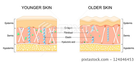 Aging skin chages. Wrinkle formation Aging skin chages. Wrinkle formation 124846453