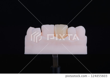 Mirror copy of central maxillary incisor, ultra thin dental ceramic veneer or crown on printed model Mirror copy of central maxillary incisor, ultra thin dental ceramic veneer or crown on printed model 124855603