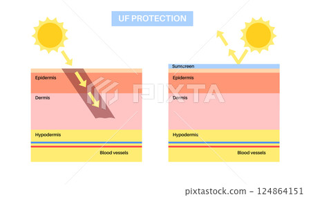 Skin UF protection 124864151