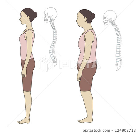 插圖:一位女士側臥的姿勢,包括正確姿勢和錯誤姿勢,以及一個易於理解的骨架 插圖:一位女士側臥的姿勢,包括正確姿勢和錯誤姿勢,以及一個易於理解的骨架 124902718