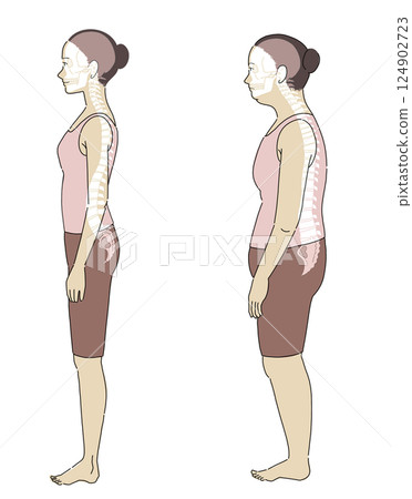Illustration of a woman lying sideways with good and bad posture and an easy-to-understand skeleton Illustration of a woman lying sideways with good and bad posture and an easy-to-understand skeleton 124902723