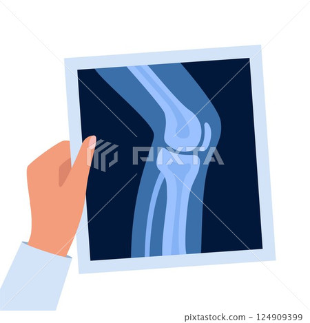 X-ray anatomy of the knee joint and human leg. Roentgen shot in doctors hand. Vector illustration. 124909399