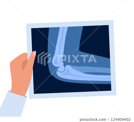 Xray scan of elbow joint. Anatomical structure, care and diagnosis for pain in arm. Roentgen shot in doctors hand. Vector illustration. 124909402