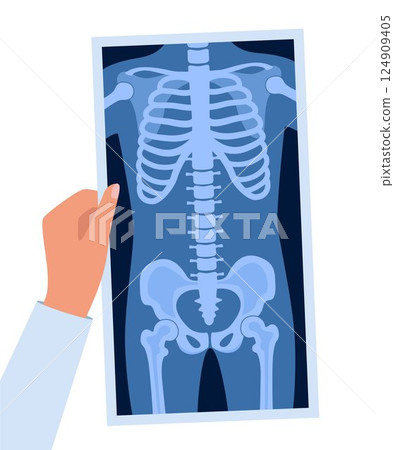 Human skeleton chest x ray image. Torso roentgen shot. Medical analyzing. Anatomical bone medicine laboratory radial scan picture. Roentgen shot in doctors hand. Vector illustration. 124909405