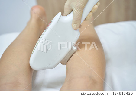 Laser hair removal on female legs in spa setting with gloved hand and device Laser hair removal on female legs in spa setting with gloved hand and device 124913429
