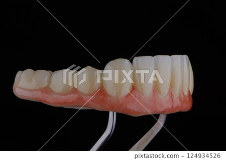 Full dental zirconium prosthesis on titanium bar stained with stains for ceramic Full dental zirconium prosthesis on titanium bar stained with stains for ceramic 124934526