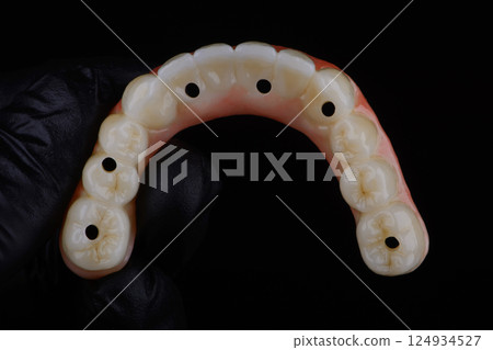 Full dental zirconium prosthesis on titanium bar stained with stains for ceramic 124934527