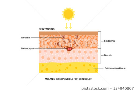 Skin damage from sunburn 124940807