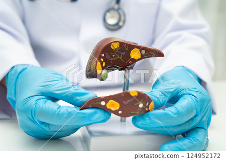 Liver with gallbladder, pancreas spleen and duodenum, Asian doctor holding human anatomy model for study diagnosis and treatment in hospital. Liver with gallbladder, pancreas spleen and duodenum, Asian doctor holding human anatomy model for study diagnosis and treatment in hospital. 124952172