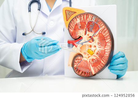 Chronic kidney disease, doctor with model for treatment urinary system, urology, Estimated glomerular filtration rate eGFR. Chronic kidney disease, doctor with model for treatment urinary system, urology, Estimated glomerular filtration rate eGFR. 124952856