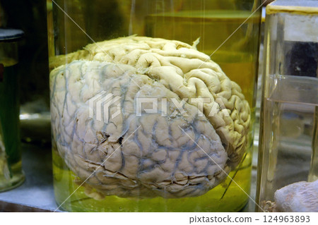 Real human brain. Anatomy of brain, grey substance, grey matter, cortical grey 124963893